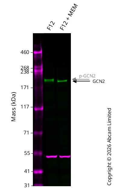 Western blot - Anti-GCN2 antibody [EPR5970(2)] (AB134053)