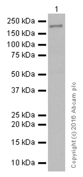 Western blot - Anti-GCN2 antibody [EPR5970(2)] (AB134053)