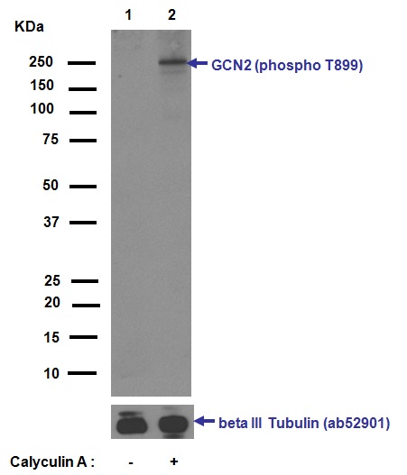 Western blot - Anti-GCN2 (phospho T899) antibody [EPR2320Y] (AB75836), expandable thumbnail