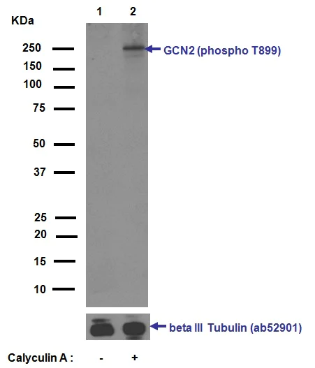 Western blot - Anti-GCN2 (phospho T899) antibody [EPR2320Y] (AB75836)