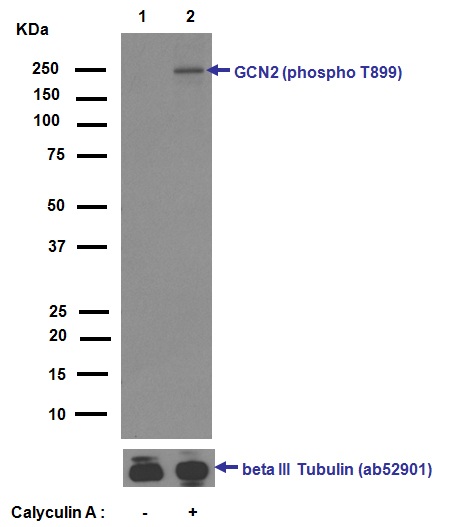 Western blot - Anti-GCN2 (phospho T899) antibody [EPR2320Y] (AB75836), expandable thumbnail