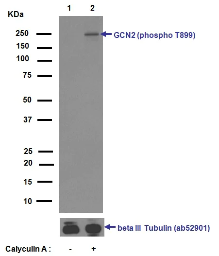 Western blot - Anti-GCN2 (phospho T899) antibody [EPR2320Y] (AB75836)