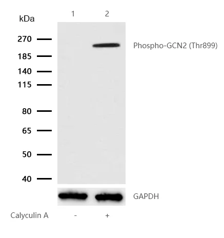 Western blot - Anti-GCN2 (phospho T899) antibody [SR1336] (AB326641)