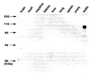 Western blot - Anti-GCNA1 antibody [TRA98] (AB82527)
