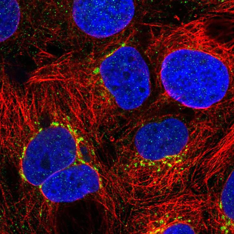 Immunocytochemistry/ Immunofluorescence - Anti-GCNT2 antibody (AB121888)