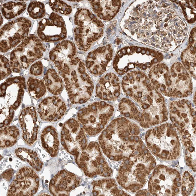 Immunohistochemistry (Formalin/PFA-fixed paraffin-embedded sections) - Anti-GCNT2 antibody (AB121888)