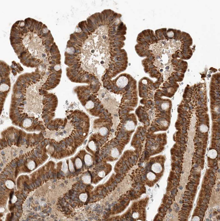 Immunohistochemistry (Formalin/PFA-fixed paraffin-embedded sections) - Anti-GCNT2 antibody (AB121888)