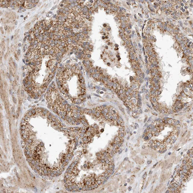 Immunohistochemistry (Formalin/PFA-fixed paraffin-embedded sections) - Anti-GCNT2 antibody (AB121888)