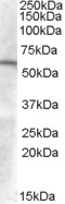 Western blot - Anti-GCNT3 antibody (AB77728), expandable thumbnail