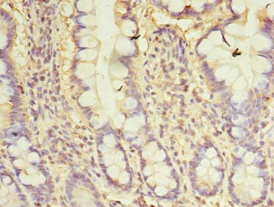 Immunohistochemistry (Formalin/PFA-fixed paraffin-embedded sections) - Anti-GCP2 antibody (AB238717), expandable thumbnail