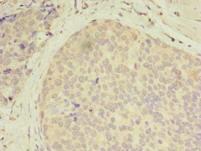 Immunohistochemistry (Formalin/PFA-fixed paraffin-embedded sections) - Anti-GCP2 antibody (AB238717), expandable thumbnail