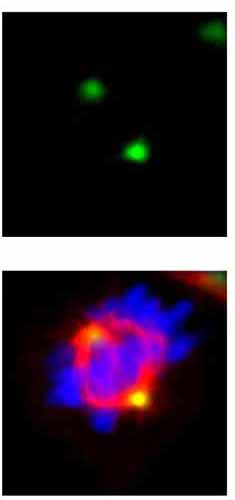Immunocytochemistry/ Immunofluorescence - Anti-GCP4 antibody (AB153939), expandable thumbnail