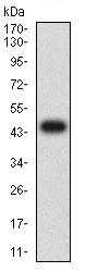 Western blot - Anti-GCSF Receptor antibody [3G10G2] (AB233833), expandable thumbnail