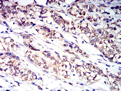 Immunohistochemistry (Formalin/PFA-fixed paraffin-embedded sections) - Anti-GCSF Receptor antibody [8F8B12] (AB233783), expandable thumbnail