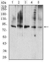 Western blot - Anti-GCSF Receptor antibody [8F8B12] (AB233783), expandable thumbnail