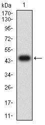 Western blot - Anti-GCSF Receptor antibody [8F8B12] (AB233783)