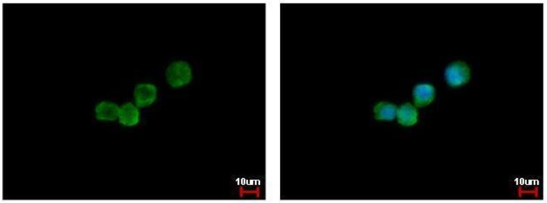Immunocytochemistry/ Immunofluorescence - Anti-GCSF Receptor antibody (AB126167), expandable thumbnail