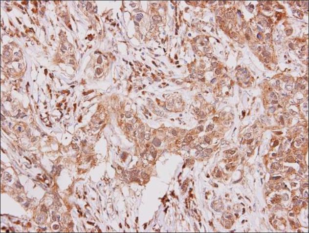 Immunohistochemistry (Formalin/PFA-fixed paraffin-embedded sections) - Anti-GCSF Receptor antibody (AB126167), expandable thumbnail