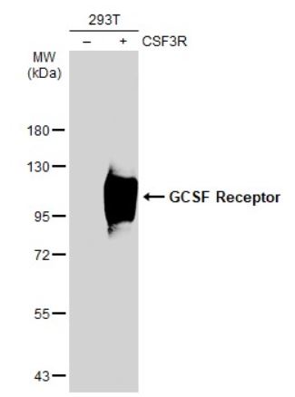 Western blot - Anti-GCSF Receptor antibody (AB126167), expandable thumbnail