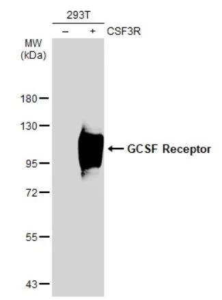 Western blot - Anti-GCSF Receptor antibody (AB126167)