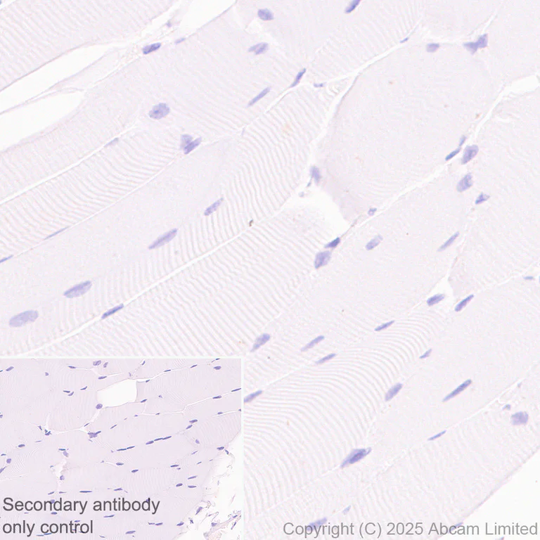 Immunohistochemistry (Formalin/PFA-fixed paraffin-embedded sections) - Anti-GCSF Receptor antibody [EPR26507-386] - BSA and Azide free (AB324572)