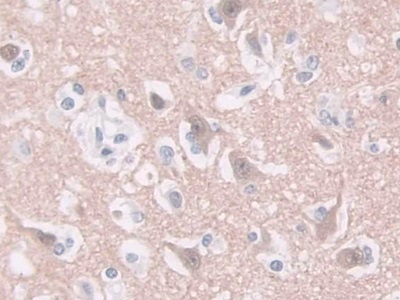 Immunohistochemistry (Formalin/PFA-fixed paraffin-embedded sections) - Anti-GDA antibody (AB233221)