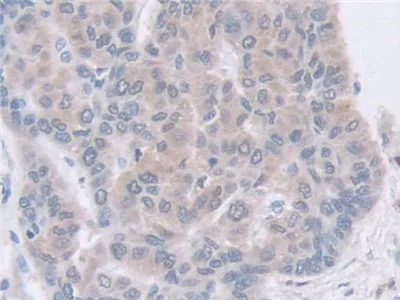 Immunohistochemistry (Formalin/PFA-fixed paraffin-embedded sections) - Anti-GDA antibody (AB233221)