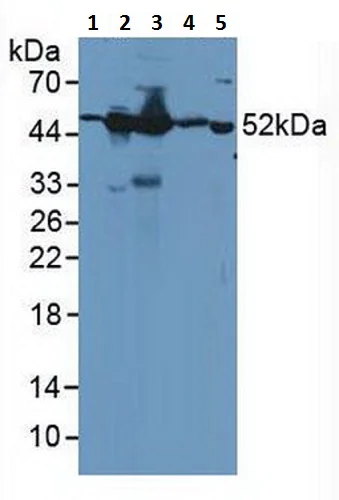 Western blot - Anti-GDA antibody (AB233221)