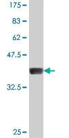 Western blot - Anti-GDAP1 antibody (AB194493)