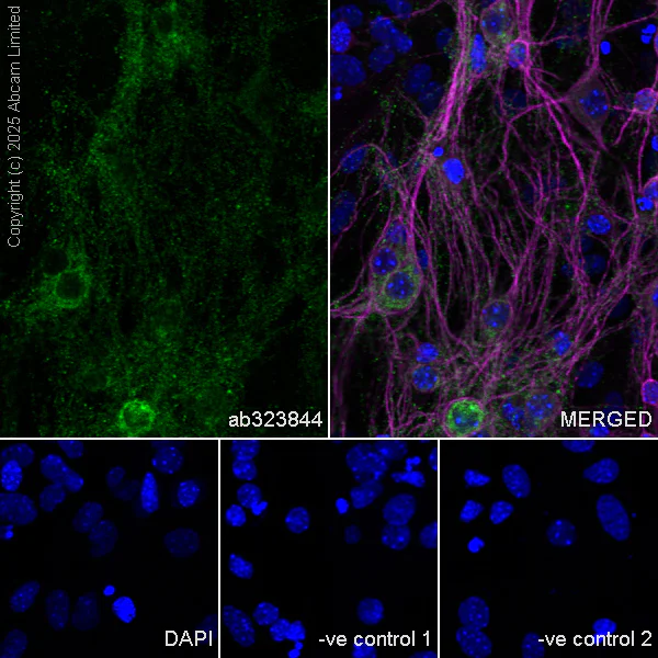 Immunocytochemistry/ Immunofluorescence - Anti-GDAP1 antibody [EPR29581-48] (AB323844)