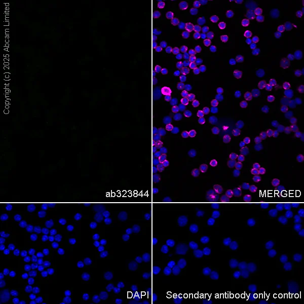 Immunocytochemistry/ Immunofluorescence - Anti-GDAP1 antibody [EPR29581-48] (AB323844)