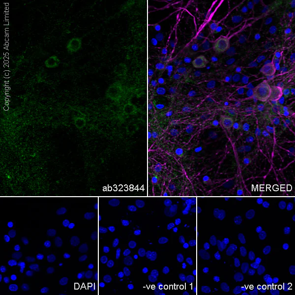 Immunocytochemistry/ Immunofluorescence - Anti-GDAP1 antibody [EPR29581-48] (AB323844)