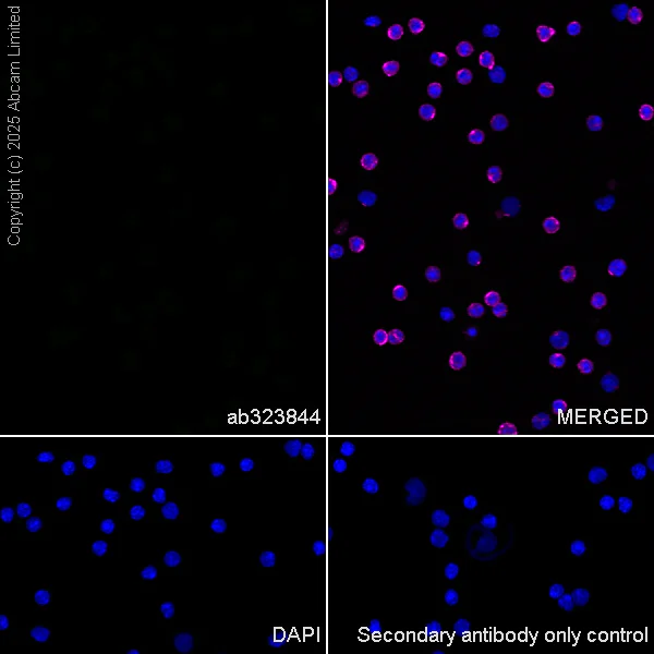 Immunocytochemistry/ Immunofluorescence - Anti-GDAP1 antibody [EPR29581-48] (AB323844)