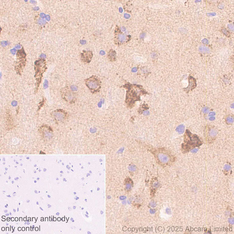 Immunohistochemistry (Formalin/PFA-fixed paraffin-embedded sections) - Anti-GDAP1 antibody [EPR29581-48] (AB323844)