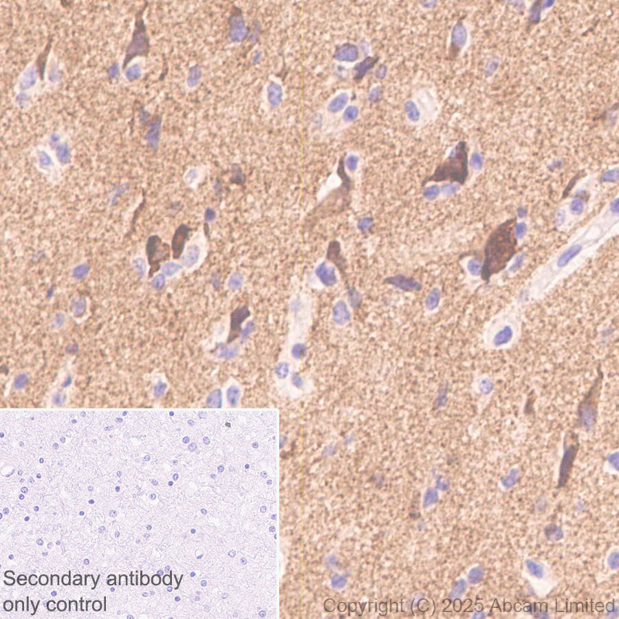 Immunohistochemistry (Formalin/PFA-fixed paraffin-embedded sections) - Anti-GDAP1 antibody [EPR29581-48] (AB323844), expandable thumbnail