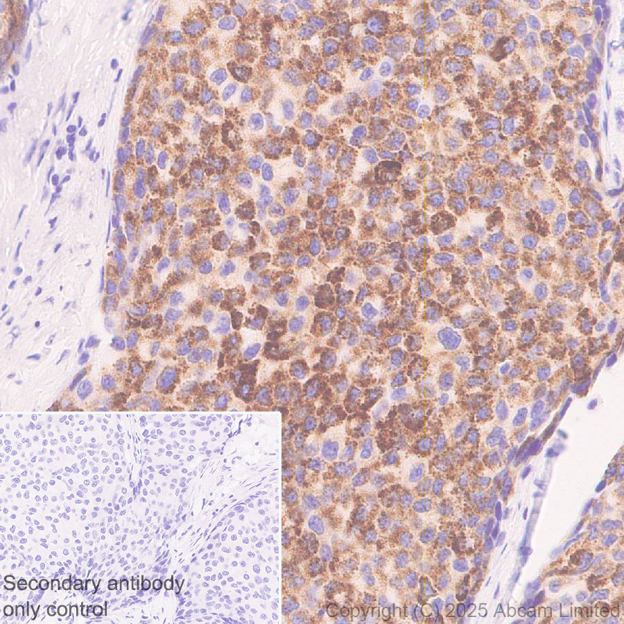 Immunohistochemistry (Formalin/PFA-fixed paraffin-embedded sections) - Anti-GDAP1 antibody [EPR29581-48] (ab323844), expandable thumbnail