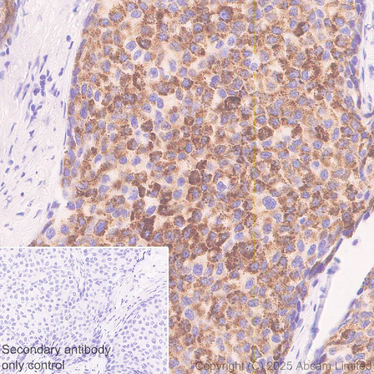 Immunohistochemistry (Formalin/PFA-fixed paraffin-embedded sections) - Anti-GDAP1 antibody [EPR29581-48] (AB323844)