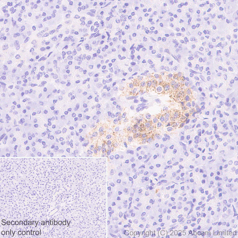 Immunohistochemistry (Formalin/PFA-fixed paraffin-embedded sections) - Anti-GDAP1 antibody [EPR29581-48] (AB323844)