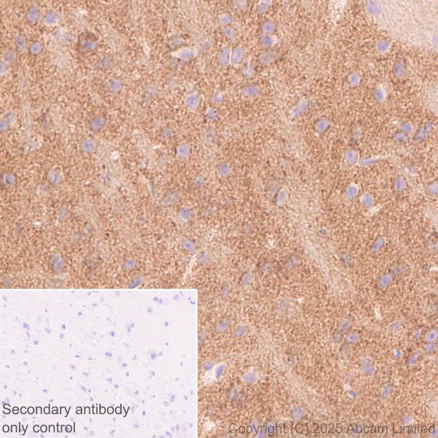 Immunohistochemistry (Formalin/PFA-fixed paraffin-embedded sections) - Anti-GDAP1 antibody [EPR29581-48] (ab323844), expandable thumbnail