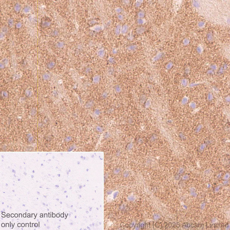 Immunohistochemistry (Formalin/PFA-fixed paraffin-embedded sections) - Anti-GDAP1 antibody [EPR29581-48] (AB323844)