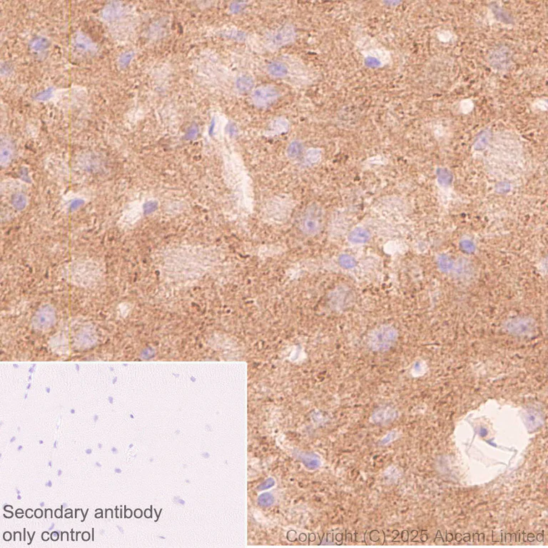 Immunohistochemistry (Formalin/PFA-fixed paraffin-embedded sections) - Anti-GDAP1 antibody [EPR29581-48] (AB323844)