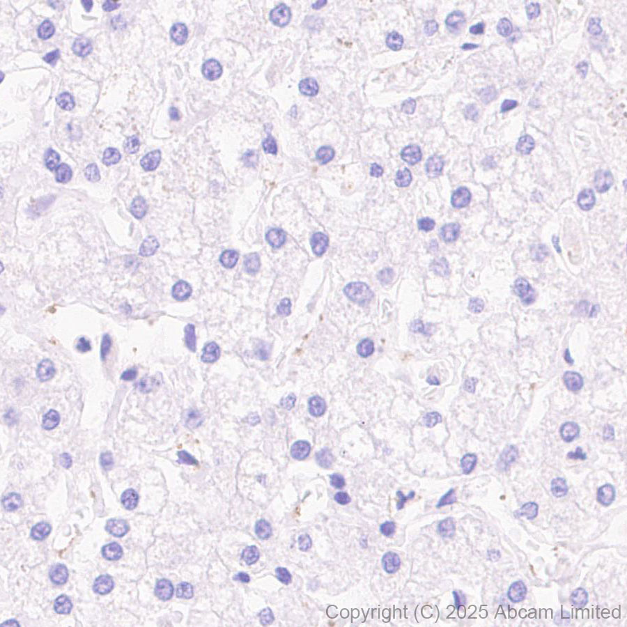 Immunohistochemistry (Formalin/PFA-fixed paraffin-embedded sections) - Anti-GDAP1 antibody [EPR29581-48] (ab323844), expandable thumbnail