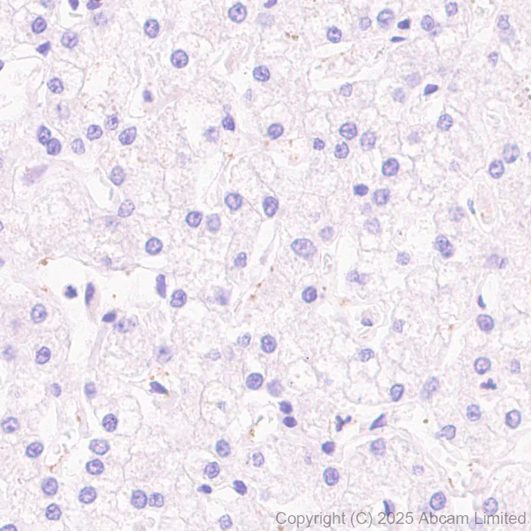 Immunohistochemistry (Formalin/PFA-fixed paraffin-embedded sections) - Anti-GDAP1 antibody [EPR29581-48] (AB323844)
