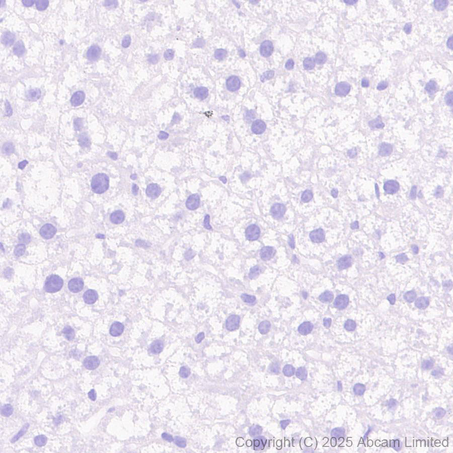 Immunohistochemistry (Formalin/PFA-fixed paraffin-embedded sections) - Anti-GDAP1 antibody [EPR29581-48] (ab323844), expandable thumbnail