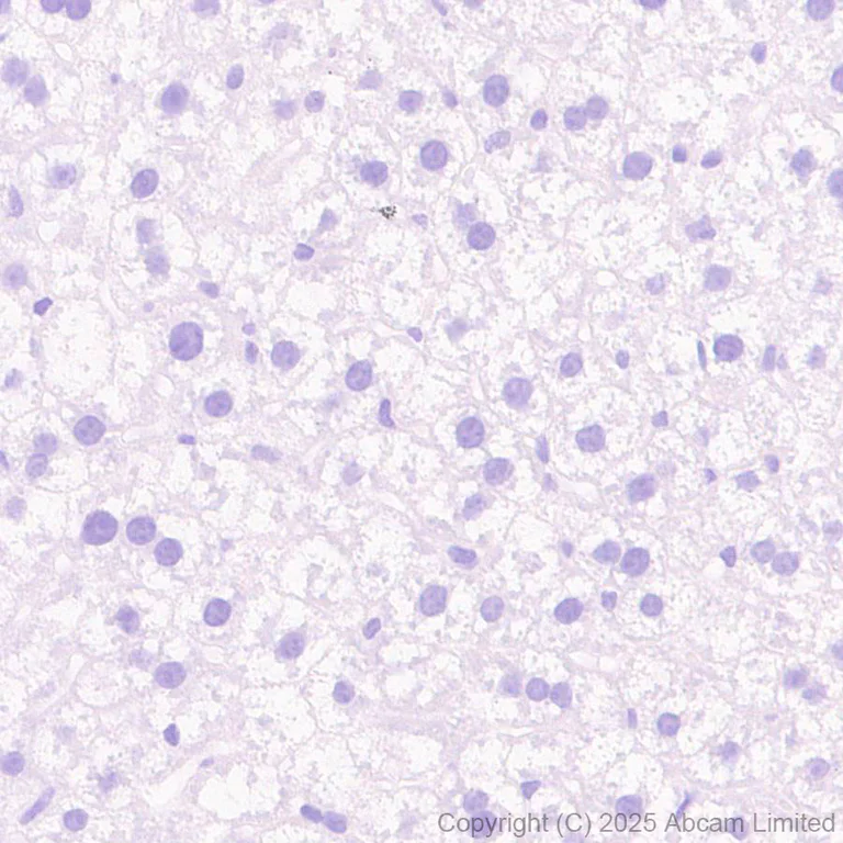 Immunohistochemistry (Formalin/PFA-fixed paraffin-embedded sections) - Anti-GDAP1 antibody [EPR29581-48] (AB323844)