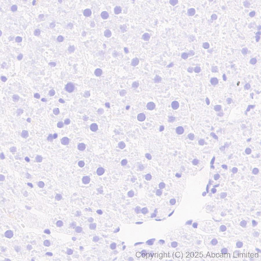 Immunohistochemistry (Formalin/PFA-fixed paraffin-embedded sections) - Anti-GDAP1 antibody [EPR29581-48] (ab323844), expandable thumbnail