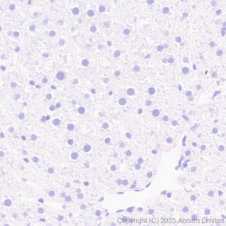 Immunohistochemistry (Formalin/PFA-fixed paraffin-embedded sections) - Anti-GDAP1 antibody [EPR29581-48] (AB323844)