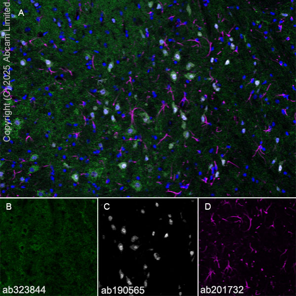 Immunohistochemistry (Frozen sections) - Anti-GDAP1 antibody [EPR29581-48] (ab323844), expandable thumbnail