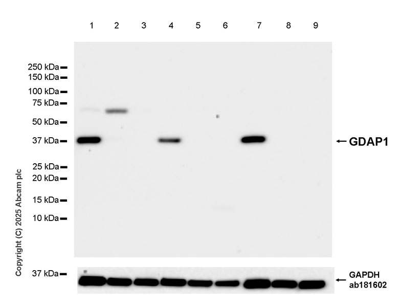 Western blot - Anti-GDAP1 antibody [EPR29581-48] (AB323844), expandable thumbnail