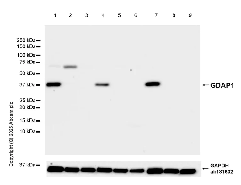 Western blot - Anti-GDAP1 antibody [EPR29581-48] (AB323844)